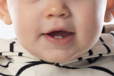 Kenali Gejala Infeksi Jamur pada Bayi